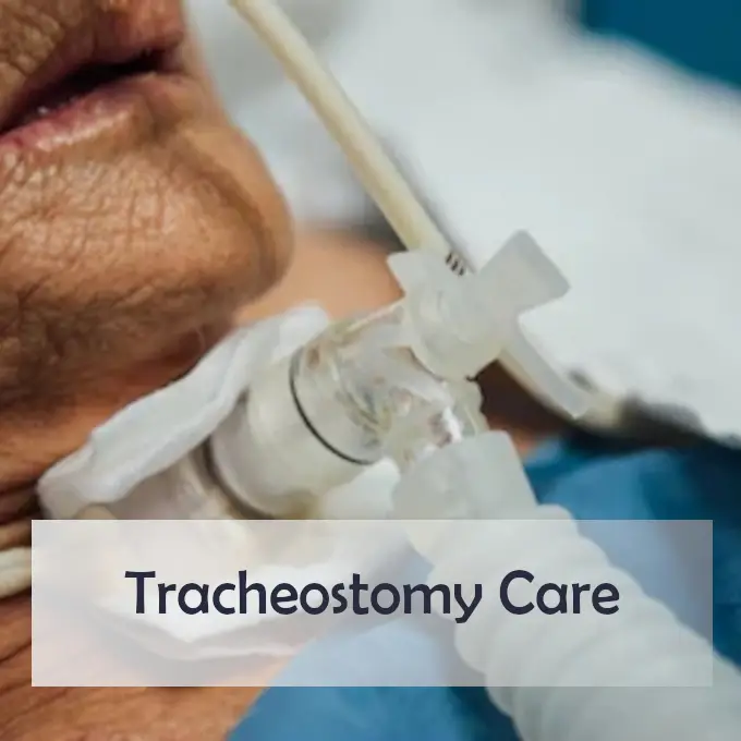 tracheostomy